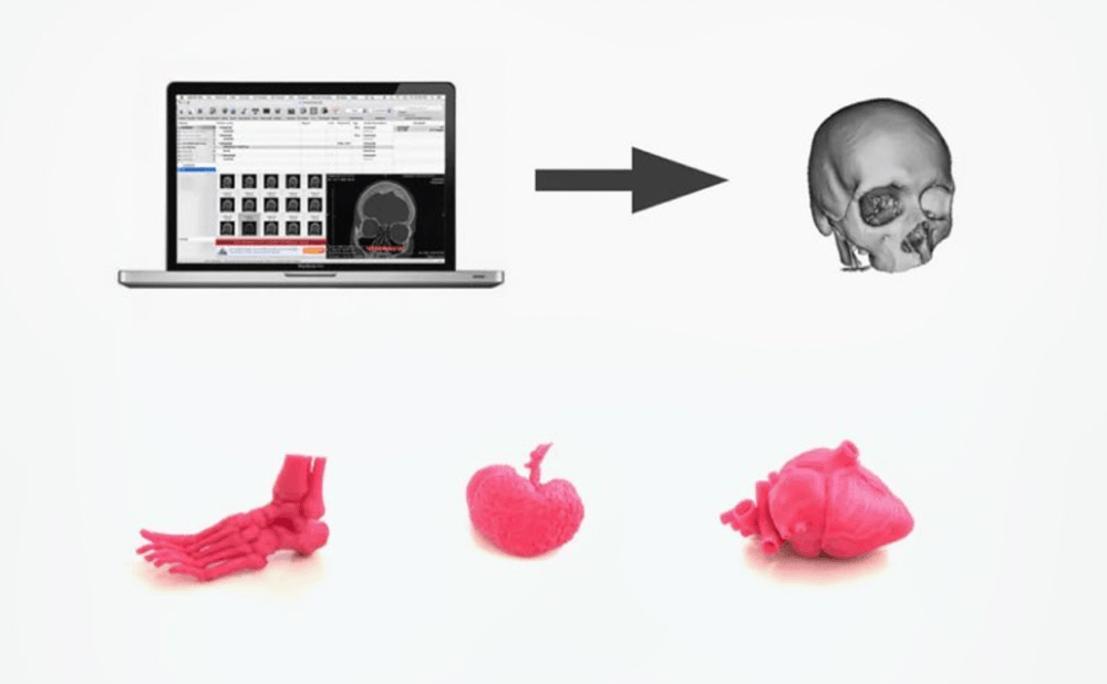 3D printed medical scans